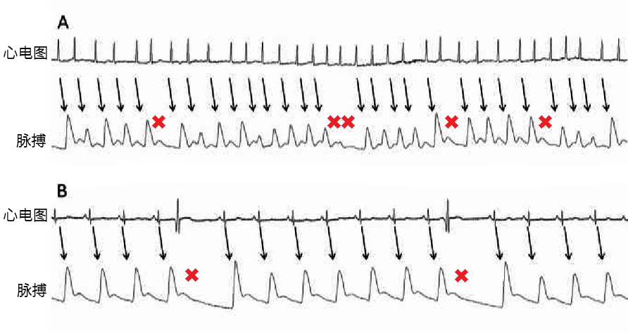 腾讯分分彩：为什么手表显示的“心率”很离谱？因为它根本没测心跳