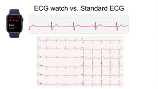 腾讯分分彩：为什么手表显示的“心率”很离谱？因为它根本没测心跳